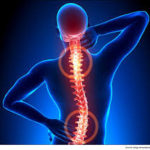 spinal decompression, sciatica, herniated disc, back pain